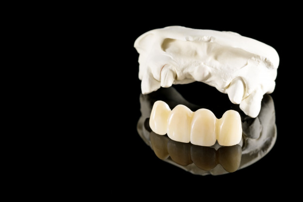 restauração de dentes