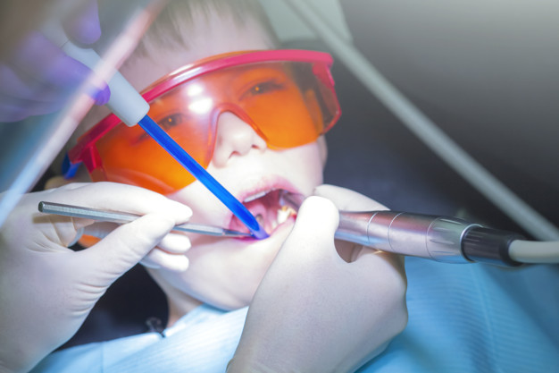tratamento de canal dental